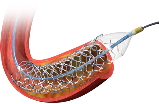 BIOMATRIX NEOFLEX